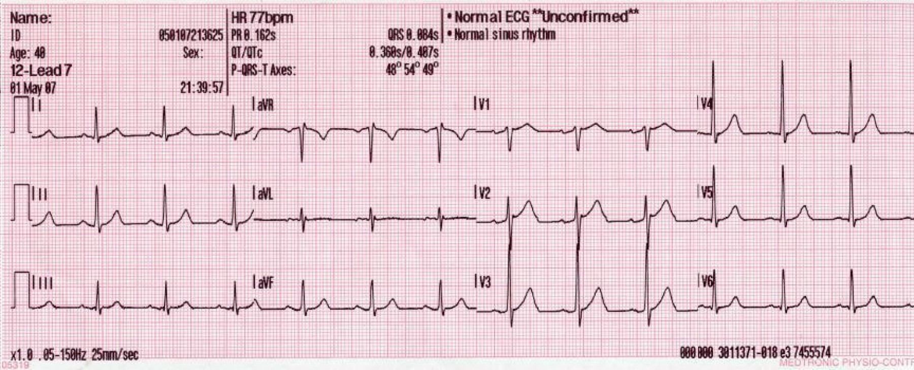 Best Practice Medicine 12 Lead Generated Sinus Rhythm