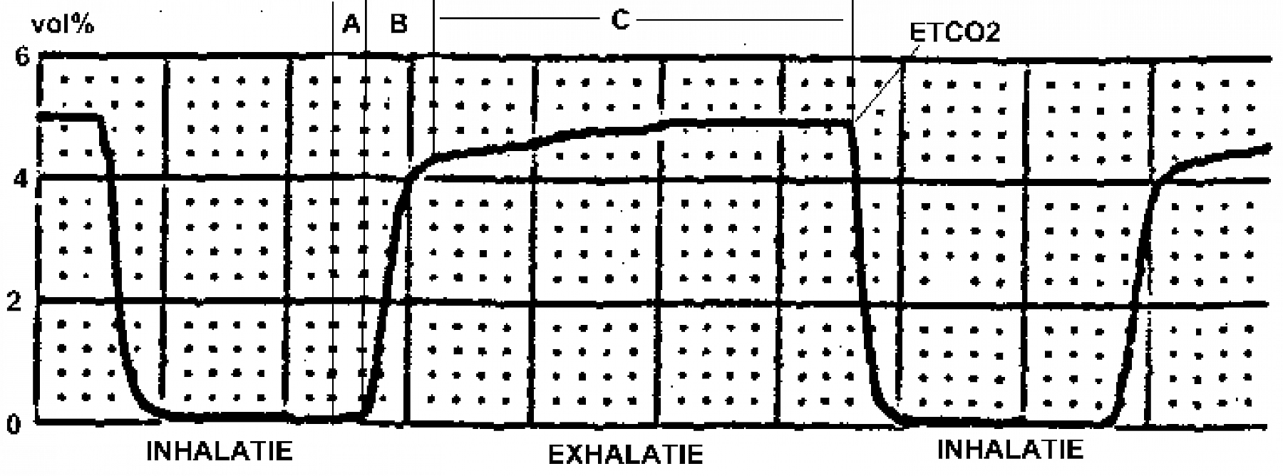 Best Practice Medicine Capnogram